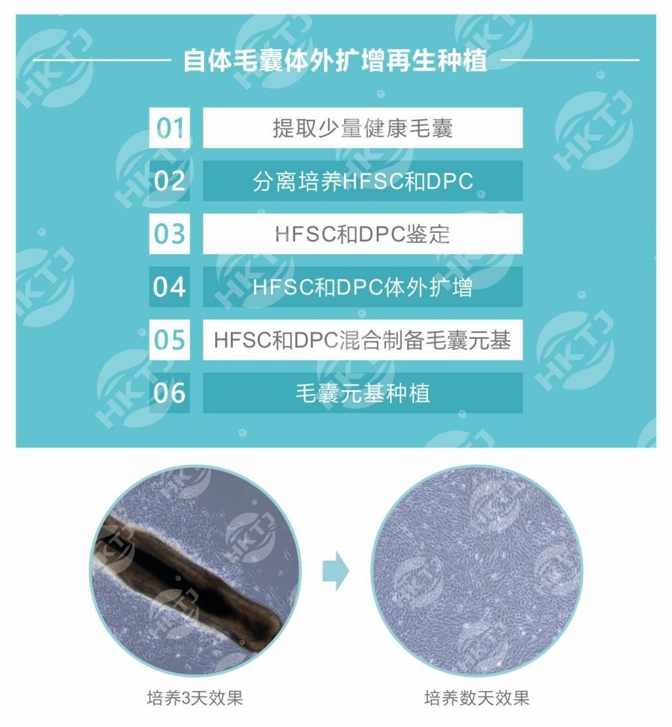 毛囊干细胞生发？最新技术帮助您解决脱发问题