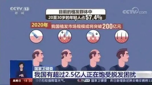杭州新生植发主推植养护体系，彰显“头”部机构优势
