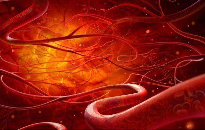 什么是视网膜新生血管？