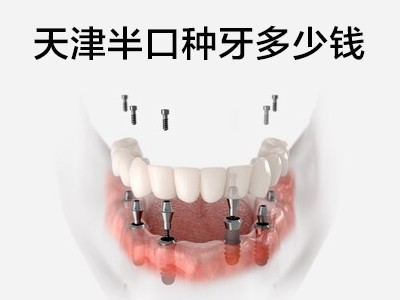 天津半口种植牙的价格一般多少钱