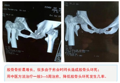 仁心仁术铸就名医之路—张雨更